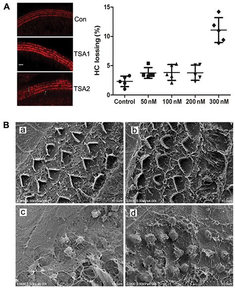 Hair usually begins falling out two to four weeks after you start treatment. Trichostatin A reduces cisplatin-induced ototoxicity ...