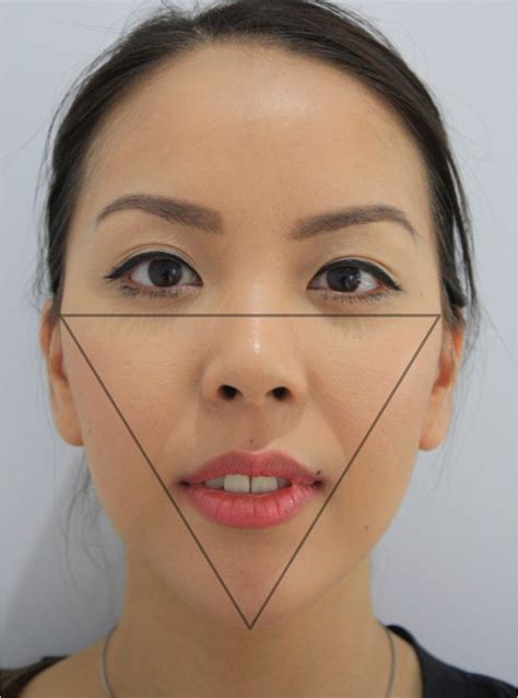 Facial Reshaping And Facial Slimming Facelove St Kilda Melbourne