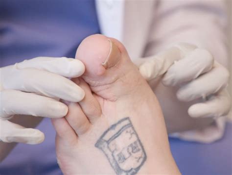 Man Suffers From Really Huge Big Toe On Tlcs ‘my Feet Are