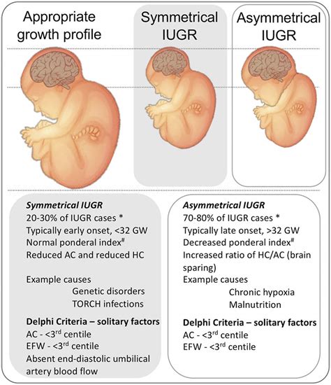 Intrauterine Growth Restriction Causes Symptoms Diagnosis Treatment