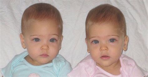These Twins From California Are Dubbed As The Most Beautiful Twins Ever Born And You Cant