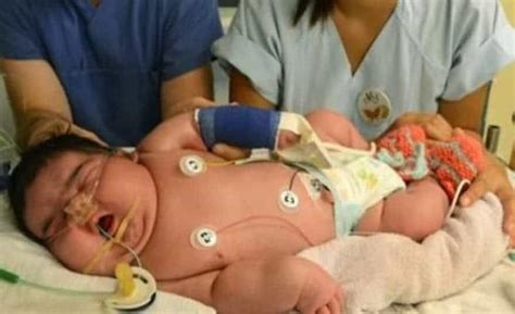 Biggest Babby Born 14 Pound Baby Born In Europe Is Largest Baby In World