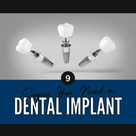 9 Signs You Need A Dental Implant Chicago Dental Implants