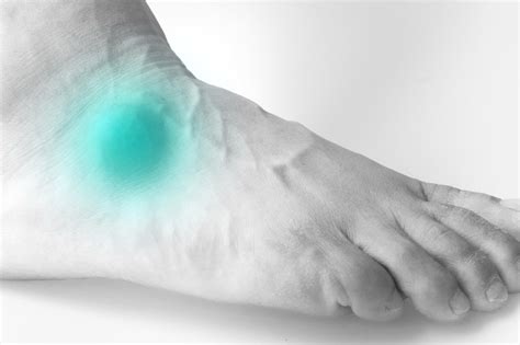 Mucoid Cyst Mississauga Foot Clinic