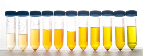 Kommt die urinfarbe einem sirup oder bier gleich, kann das ein anzeichen. Supplements and Urine - Ask The Scientists