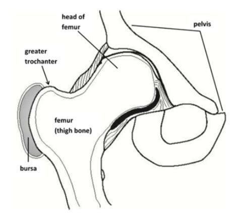 Hip Trochanteric Bursitis Tendinitis Charm Images And Photos Finder