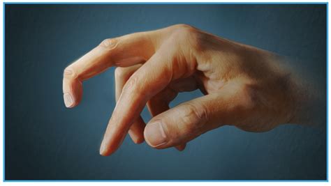 Part 1 Series Finger Joint Injuries And Extensor Tendon Rupturessprains