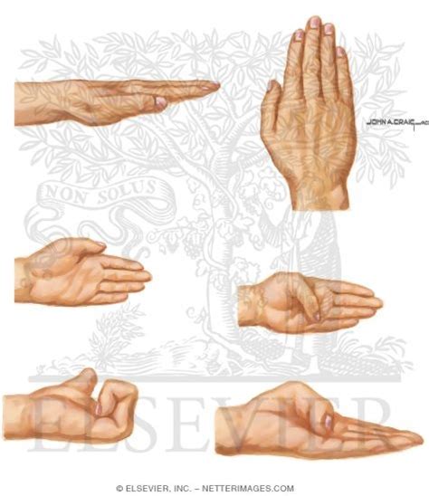 Physical Examination Of The Hand