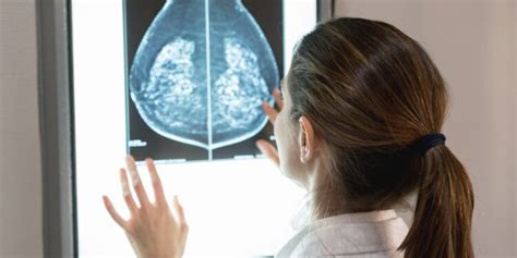 first sign of breast cancer women unaware that breast density is an increased risk factor