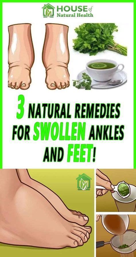 3 Natural Remedies For Swollen Ankles And Feet Foot Remedies Water