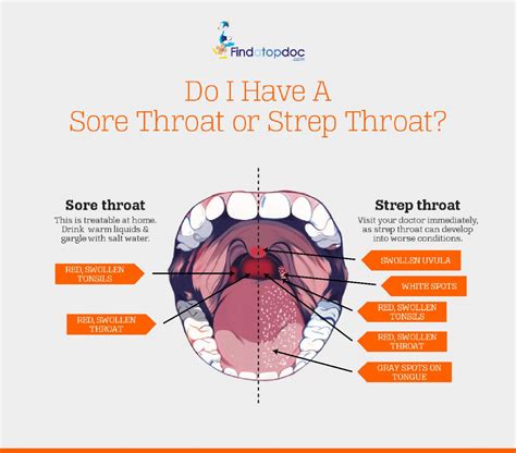 Is It A Sore Throat Or Strep Throat Visually