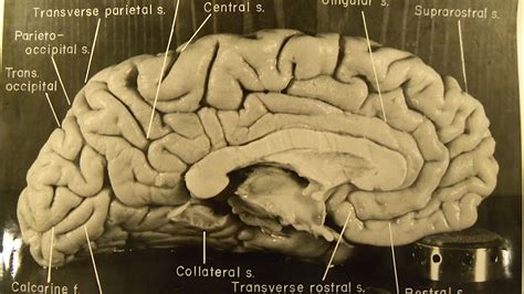 Studying The Unique Features Of Albert Einsteins Brain Britannica