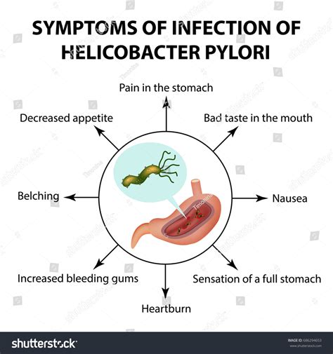 h pylori symptoms helicobacter pylori symptômes et fatigue Bojler