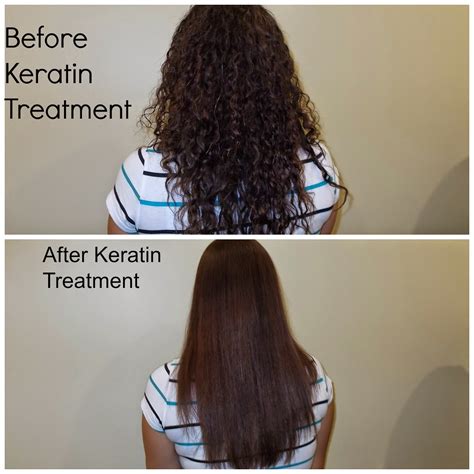 Hair Replacement Orlando Orlando Botox Treatment Vs Keratin Treatment