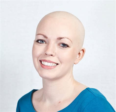 On being bald and being authentic | Katie Crushes Cancer
