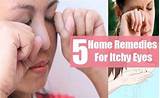 Hay Fever Home Remedies For Itchy Eyes Images
