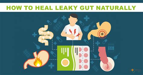 How To Heal Leaky Gut Naturally Nourishdoc