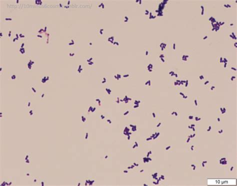 Microcosm Corynebacterium Macginleyi Eye Infection