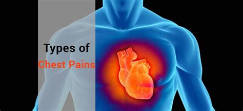 Types Of Chest Pains