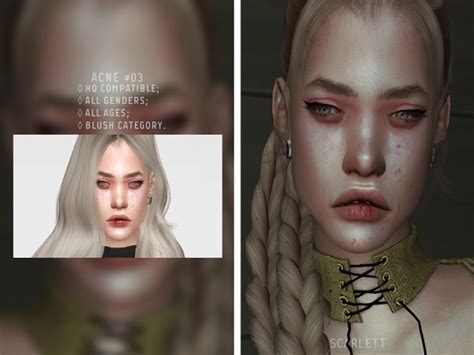 The Sims Resource Acne 03 By Scarlett Content Sims 4