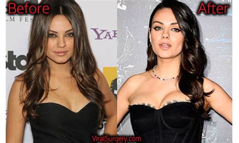 Mila Kunis Plastic Surgery Before And After Nose Boob Job Pictures