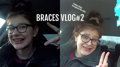Believe me, eating tacos after getting braces was the most stupid choice i have ever made. getting my bottom BRACES+ braces update - YouTube