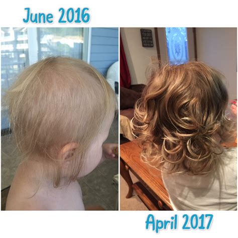 Baby hair loss is not only normal — it's common. Monat has products for everyone! This sweet little girl ...