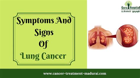 What Are The Symptoms Of Lung Cancer Nhs Lung Cancer Symptoms Why
