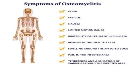 Osteomyelitis Symptoms Diagnosis And Treatment Assignment Point
