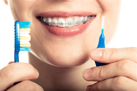 Oral Hygiene With Braces Mt Kelly Dmd
