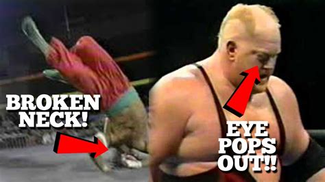 10 Most PAINFUL Wrestling Injuries Ever! - YouTube