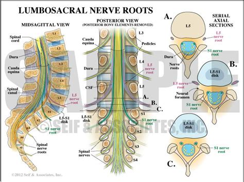 Case Study Lumbar Nerve Root Compression Nerve Anatomy Human Body