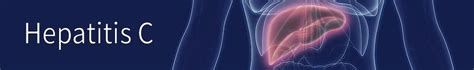 Acute hepatitis c usually goes undiagnosed because it rarely causes symptoms. Hepatitis C - FAQs, Statistics, Data, & Guidelines | CDC