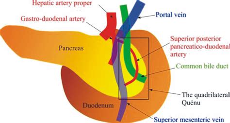 Relations Of The Retro Pancreatic Common Bile Duct Posterior View