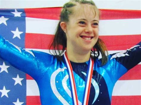 World Champion Gymnast Turned Model With Down Syndrome Shares Inspiring