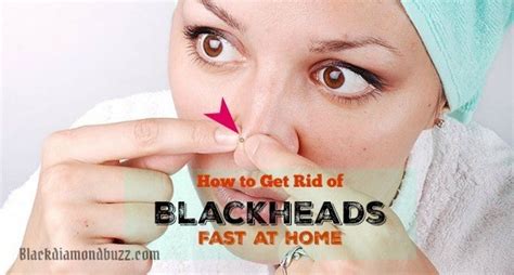 How To Get Rid Of Blackheads Fast At Home 10 Diy Home