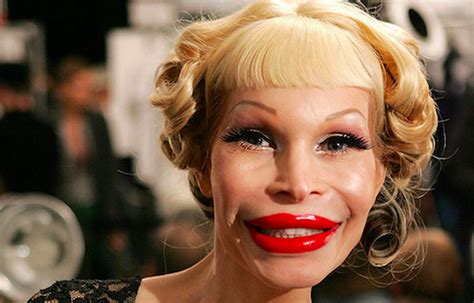 These 21 Examples Of Plastic Surgery Gone Horribly Wrong Will Haunt