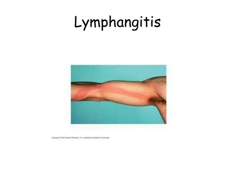 Ppt Lymphatic System Powerpoint Presentation Free Download Id2152823