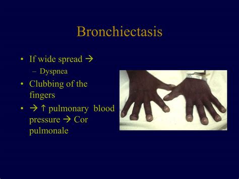 Ppt Bronchiectasis Powerpoint Presentation Free Download Id1426050