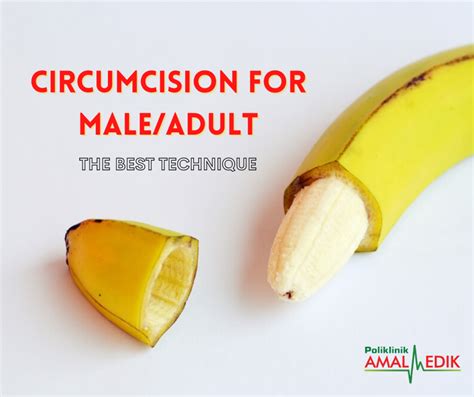 circumcision for male adult the best technique amalmedikhq