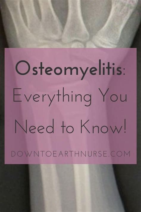 How To Spot Osteomyelitis Infographic Wound Care Nursing Wounds