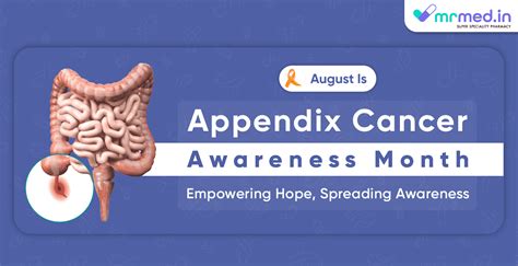 Appendix Cancer The Enigma Of A Rare Disease Mrmed