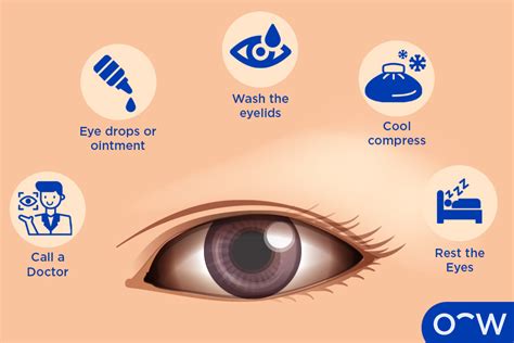 9 Common Causes Of Eye Irritation
