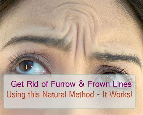 Get Rid Of Furrow And Frown Forehead Wrinkle Lines With This Natural