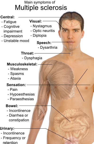 Multiple Sclerosis Symptoms And Causes Health Zineinfo