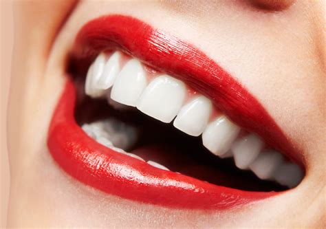 Many Benefits Of Professional Teeth Whitening Chesterland Oh