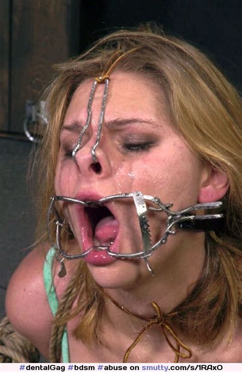 Bdsm Mouth Open Nipple O Ring Gag The Best Porn Website