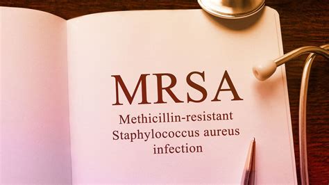 Mrsa Staph Infection What You Need To Know The Amino Company