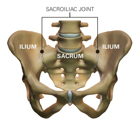 The Difference Between Sacroiliac Joint Dysfunction And Sciatica Mypain Ca