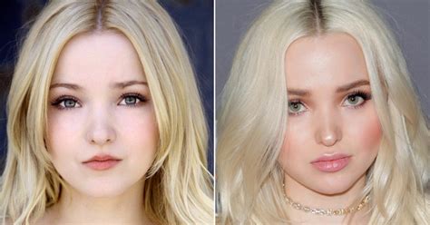 Dove Cameron Before Plastic Surgery 10 Shocking Facts About Dove